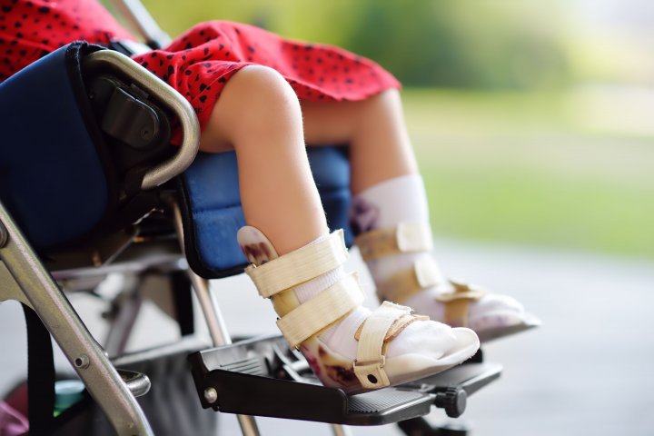 Ein Mädchen sitzt in einem Rollstuhl. An ihren Beinen trägt sie Orthesen.